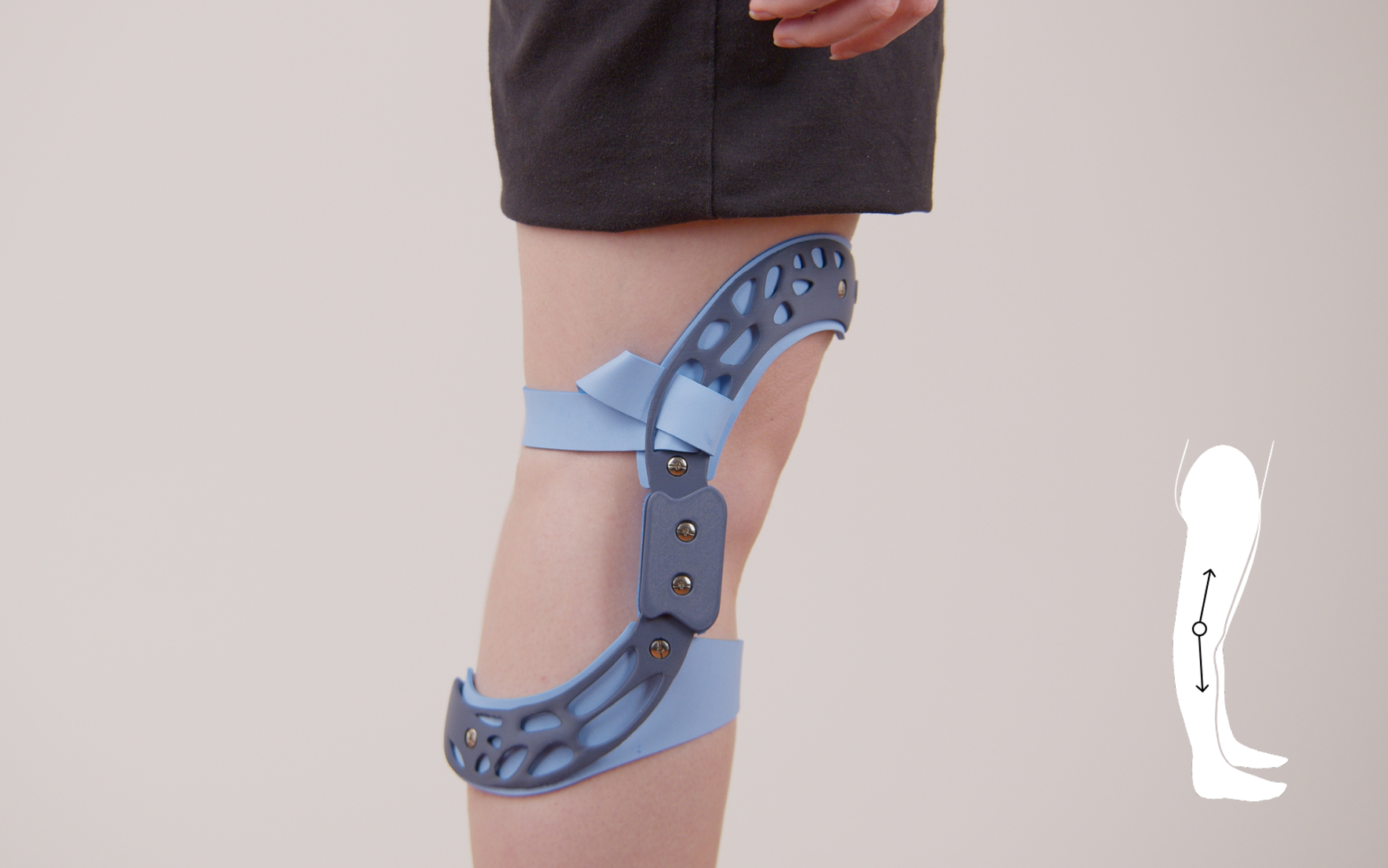 Persona indossa un tutore ortopedico blu leggero e regolabile sul ginocchio per supporto e mobilità.